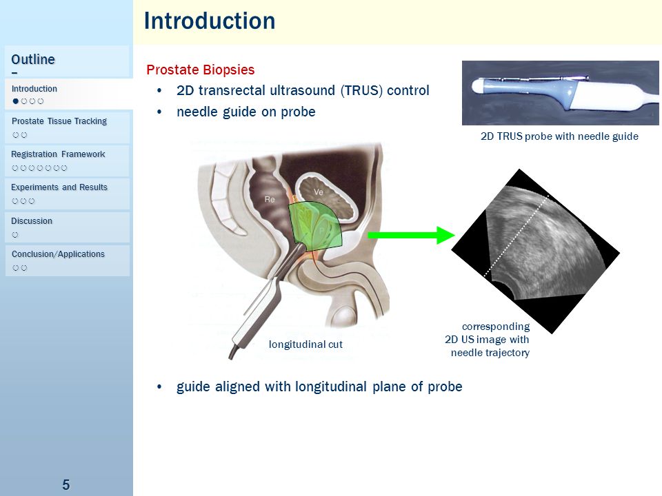 How do you take a biopsy of the prostate